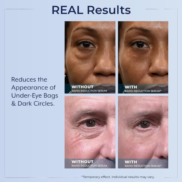 💧🌿Plexaderm Rapid Reduction Serum ✨Instant Skin Firming & Lifting