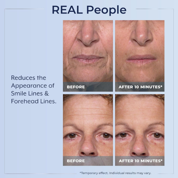 💧🌿Plexaderm Rapid Reduction Serum ✨Instant Skin Firming & Lifting